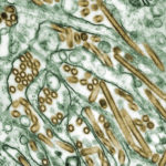 Colorized_transmission_electron_micrograph_of_Avian_influenza_A_H5N1_viruses
