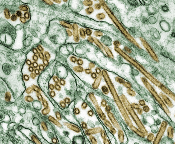 Colorized_transmission_electron_micrograph_of_Avian_influenza_A_H5N1_viruses