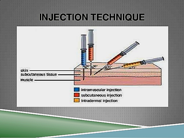 Injection Technique