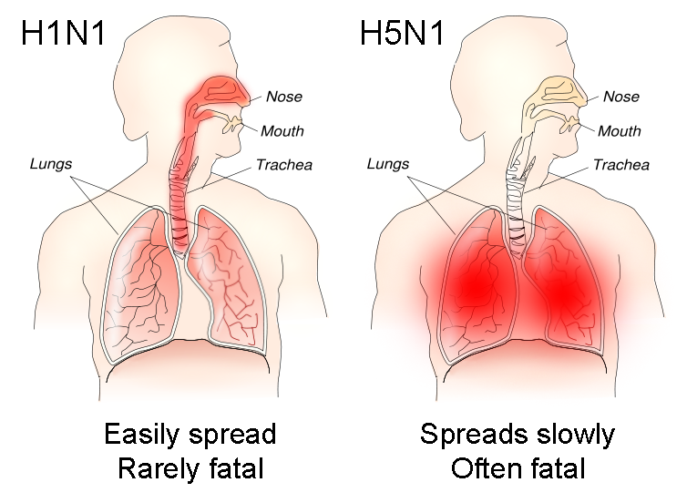 Bird Flu - H1N1 versus H5N1 pathology