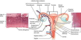 Signs and Symptoms of Cervical Cancer Cervical Cancer Photo by Wikipedia