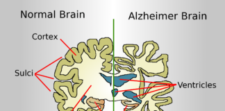 JNCASR Scientists develop a new molecule that could be a potential drug candidate for the treatment of Alzheimer’s Alzheimer