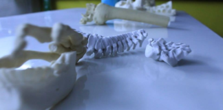 Apollo Hospitals partners with Anatomiz3D Medtech to establish Hospital 3D Printing Labs in India Anatomiz3D Medtech