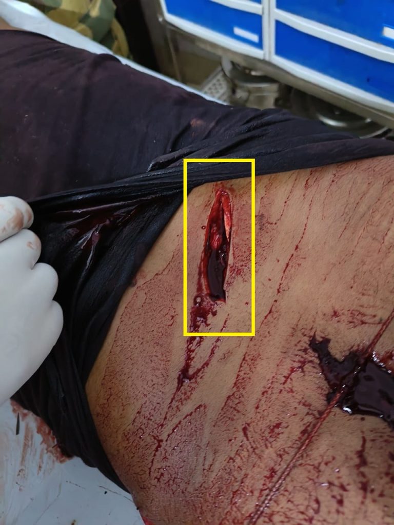 Disturbing Image not for Child- বাংলাদেশী গরু পাচারকারীদের বিএসএফ জওয়ানদের উপর মারাত্মক হামলা, এক জওয়ান গুরুতর আহত।